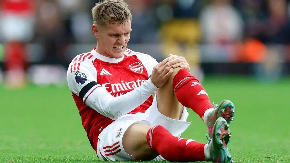 Cabin BLV: Arsenal không lo Odegaard chấn thương - Ảnh 1.